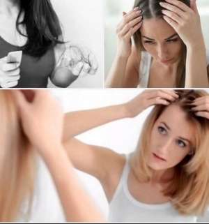 Alopecia Areata Treatment